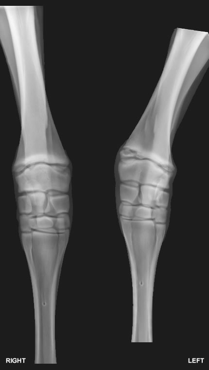 angular limb deformity